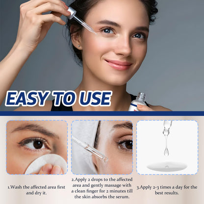 Stye Eye Treatment, Natural Non-Irritating Formula Eyelid Relief 30ml(1PCS)