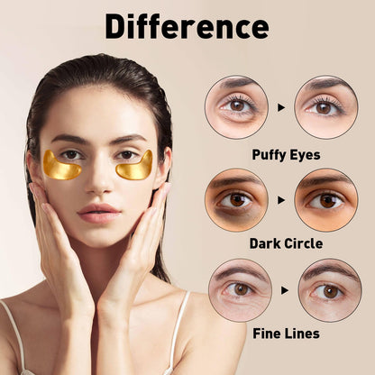 CHMI 24K Gold Under Eye Patches 100 Pairs Collagen, Dark Circles, Wrinkles