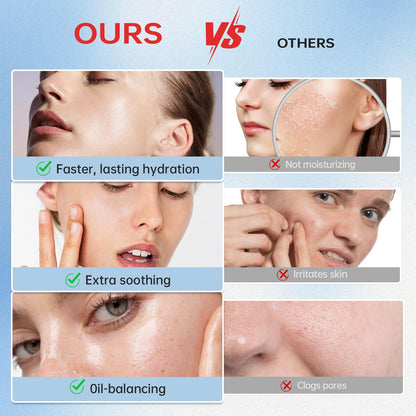 VGO Snail Mucin 92% Moisturizer Daily Face Moisturizer Hydrating Repair Face Gel Cream for Dry & Sensitive Skin, All Skin Types 50g / 1.76oz