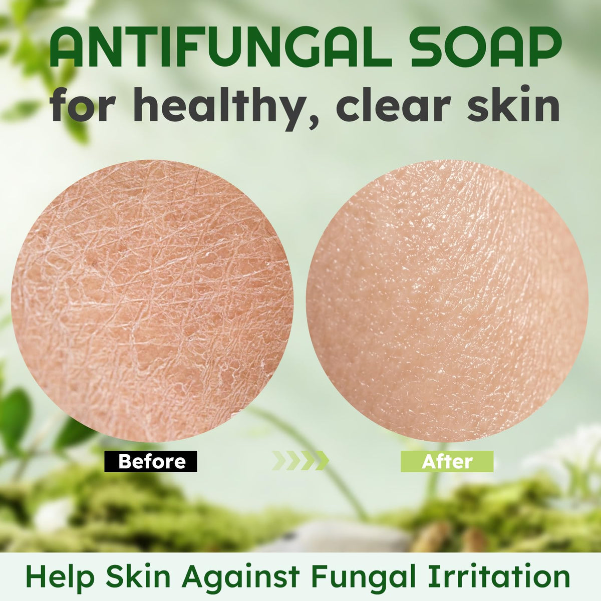 Oiangna Antifungal Soap, Antibacterial Soap Bar with Tea Tree Oil, 2 Bars