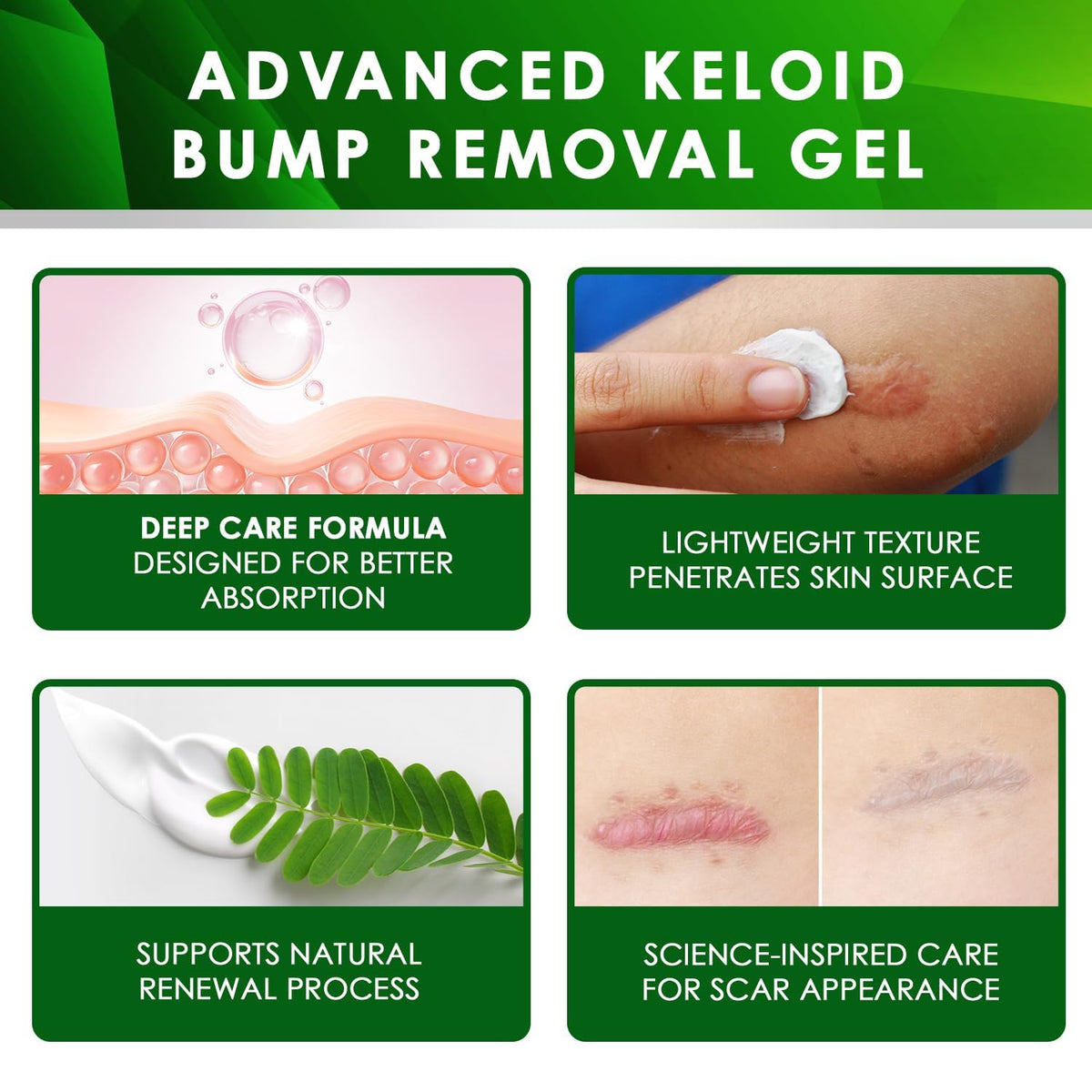 Tobcharm Advanced Keloid Bump Removal: Silicone Keloid Scar Removal Cream for Scars from Piercing, Surgical Marks, Acne, and Burns, Keloid Treatment for Ears, Face, and Body with Healing Formula 30g