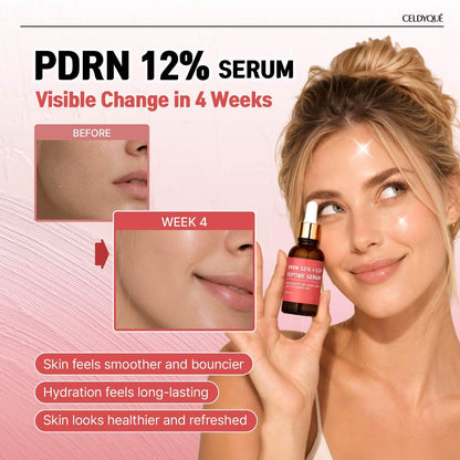 Salmon DNA PDRN 120,000 ppm EGF Peptide Microneedling Serum w/Volufiline, Phyto PDRN 12%, Growth Factor - Anti-Aging Face Serum with Niacinamide, Hyaluronic Acid 1 Fl Oz Korean Skincare