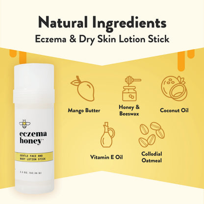 ECZEMA HONEY Gentle Face & Body Lotion Stick for Psoriasis & More (2.2 Oz)