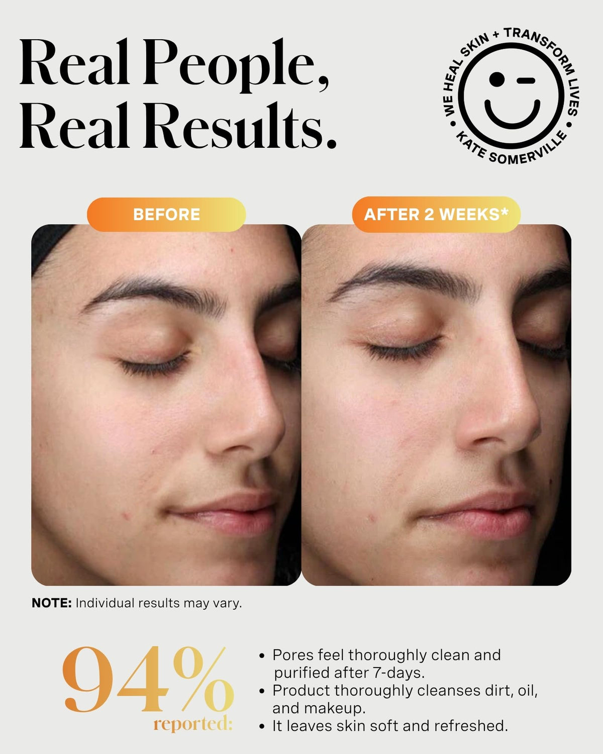 Kate Somerville ExfoliKate Cleanser, 4 Fl Oz