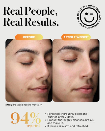 Kate Somerville ExfoliKate Cleanser, 4 Fl Oz