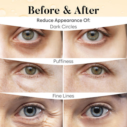 Under Eye Patches with Vitamin C and Caffeine for Puffy Eyes, Dark Circles