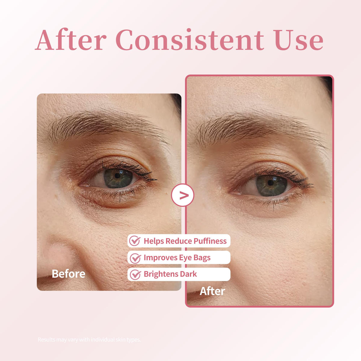 Retinol & Caffeine Under Eye Roller Serum | Xenjura Cooling Eye Cream for Puffy Eyes & Dark Circles | Anti Aging Wrinkle Remover for Fine Lines | Vegan Skincare (20ml / 0.7 fl oz)