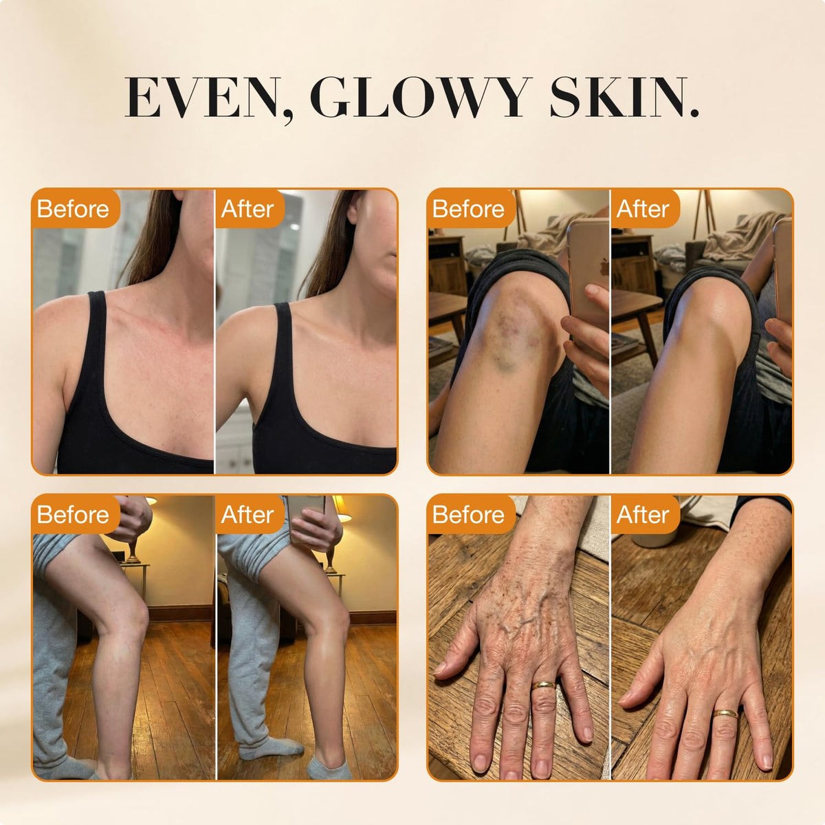 Miracle de Paris Body Coverage Perfector – Tattoo Cover Up Makeup Waterproof, Body Foundation & Leg Makeup, Transfer-Resistant Body Concealer for Legs, Scars & Uneven Skin Tone, 3.38 fl oz, Light