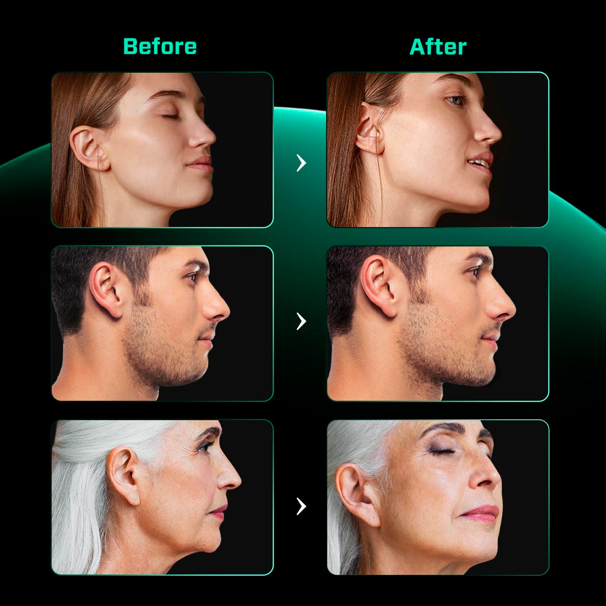 Jaw Exerciser for Men & Women – 4 Pack Set – Facial Muscle Trainer and Toner with 4 Resistance Levels – Compact Strengthener and Shaper Tool for Face & Cheek