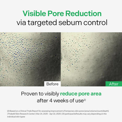 Torriden BALANCEFUL Control Serum 50ml (1.69 fl.oz.) | Daily Sebum & Oil Control for Sensitive Skin | 5D Complex Cica, 4% Niacinamide | Korean Facial Serum