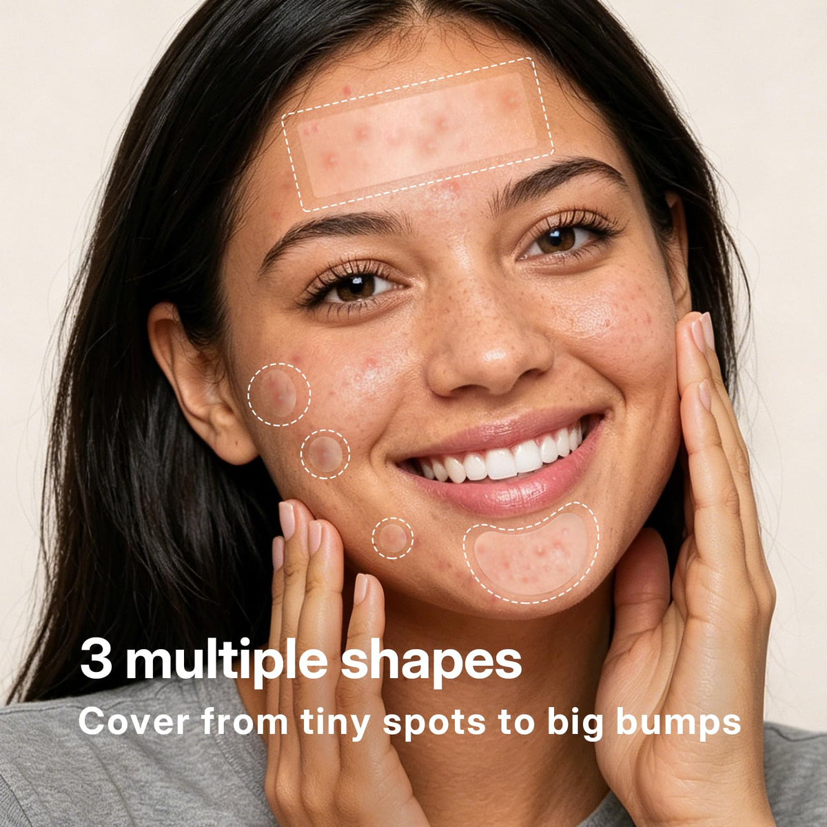 NITEEN 628 Count Pimple Patches for Face, 5 Sizes Hydrocolloid Acne Patches