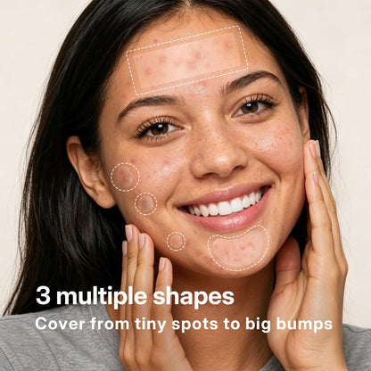 NITEEN 628 Count Pimple Patches for Face, 5 Sizes Hydrocolloid Acne Patches