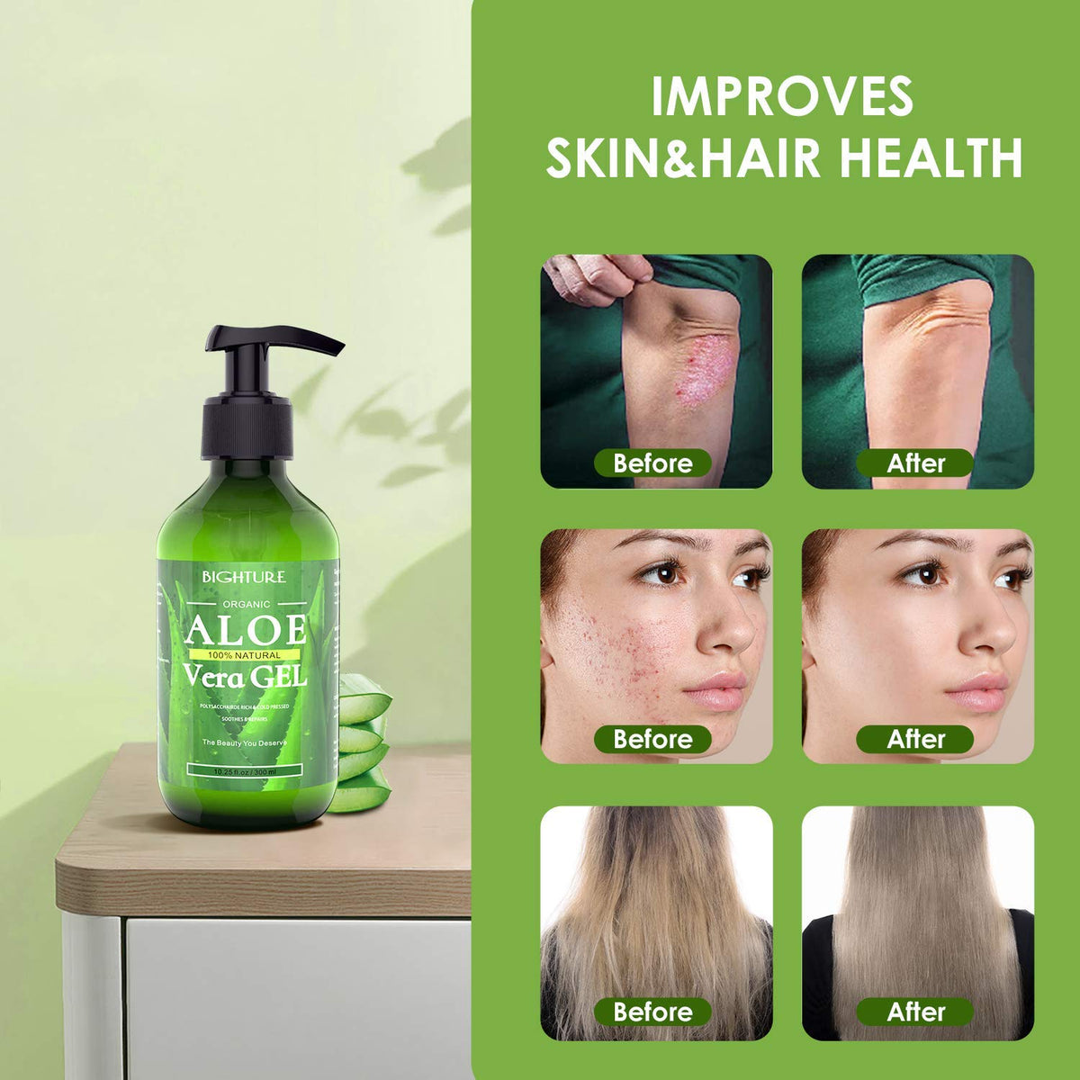 BIGHTURE Aloe Vera Gel, 100% Aloe Vera from Freshly Cut Aloe Leaves, Skin Care for Deeply & Rapidly Soothing, Firming, After Shave, Sunburn Relieve, etc