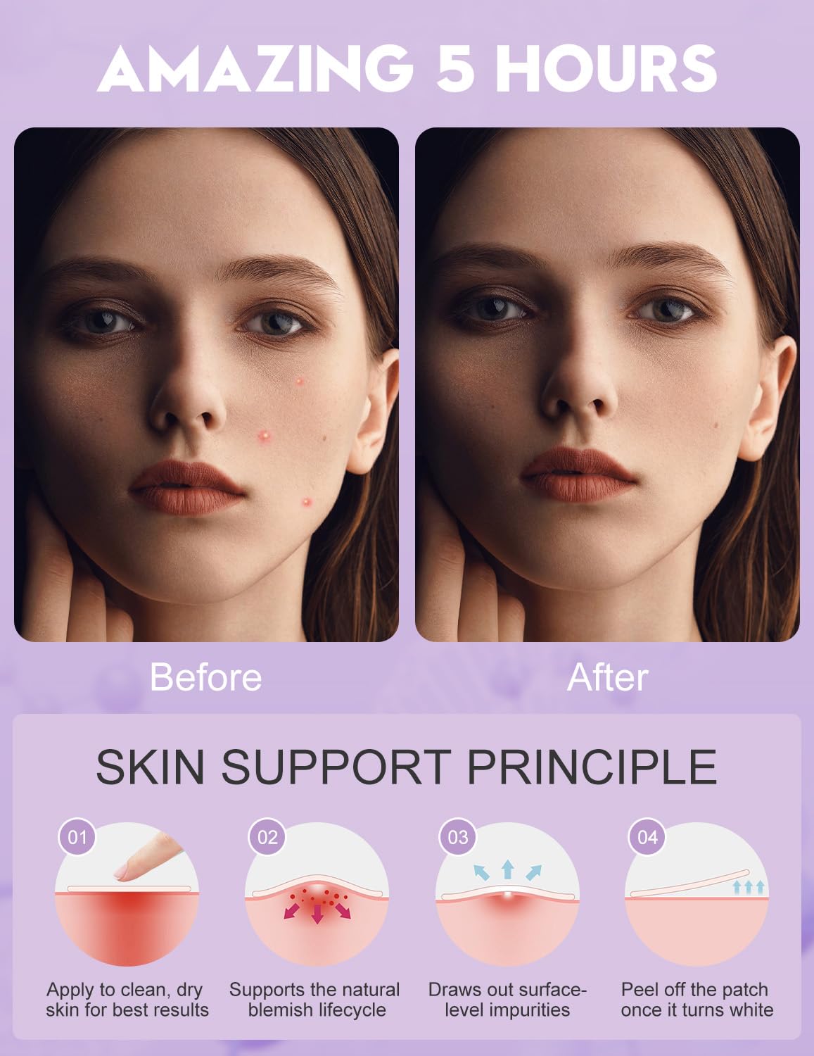 Pimple Patches for Face, 5 Sizes(8,10,12,14,16mm)108 pcs Acne Patches Hydrocolloid Precise Matches Different Sizes Acne, Spot Stickers With Tea Tree Oil Salicylic Acid Centella Covering Zits Blemishes