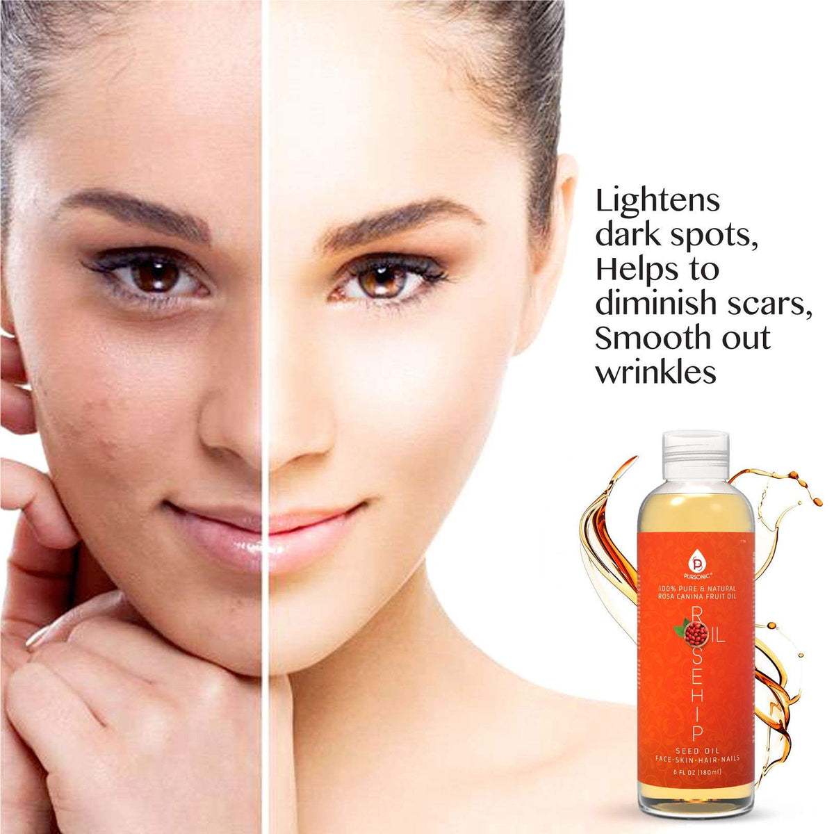 PURSONIC Pure Cold Pressed Rosehip Seed Oil for Face, Hair, Skin & Nails - Hydrating Lightweight Moisturizer for Dry Acne Prone Skin & Brightening Care with Fast Absorbing Formula - 6 Fl Oz