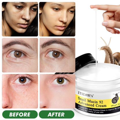 ITSDAWN Snail Mucin 92% Repair Cream 100g, Face Moisturizer Hydrating Repair Face Cream for Dry & Sensitive Skin, All Skin Types