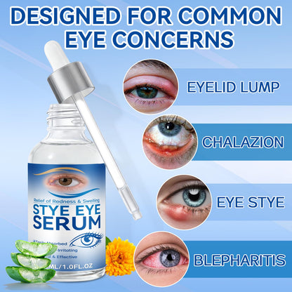 Stye Eye Treatment, 30ml Natural Eye Serum, Eye Stye Relief Serum for Eye Styes, Blepharitis, Chalazions and Dry Eyes Treatment, Daily Area Cleansing, Relieves Dryness and Restores Healthier Skin