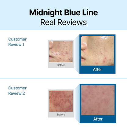 DearKlairs Blue Calming Cream - Face Moisturizer for Redness Relief, 2.11oz