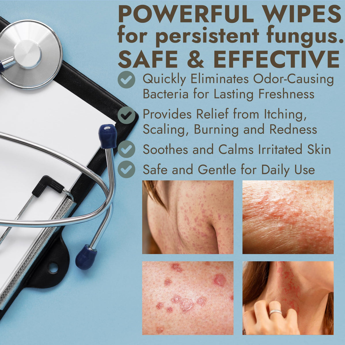 Body Wipes with 1% Tolnaftate for Ringworm, Jock Itch & Athlete's Foot