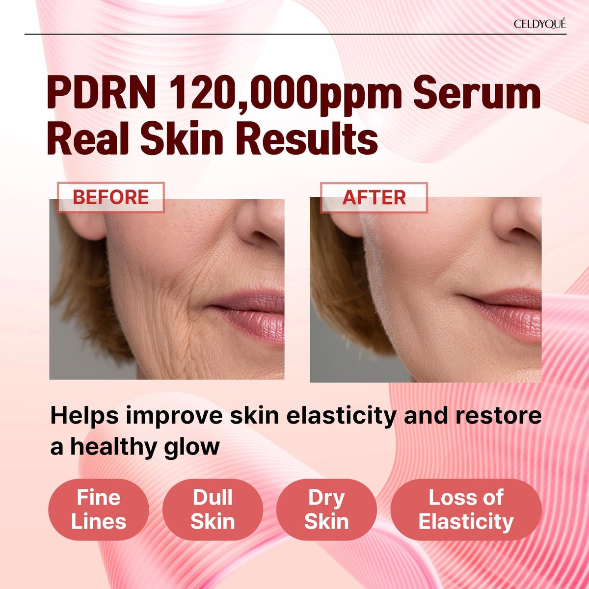 Salmon DNA PDRN 120,000 ppm EGF Peptide Microneedling Serum w/Volufiline, Phyto PDRN 12%, Growth Factor - Anti-Aging Face Serum with Niacinamide, Hyaluronic Acid 1 Fl Oz Korean Skincare