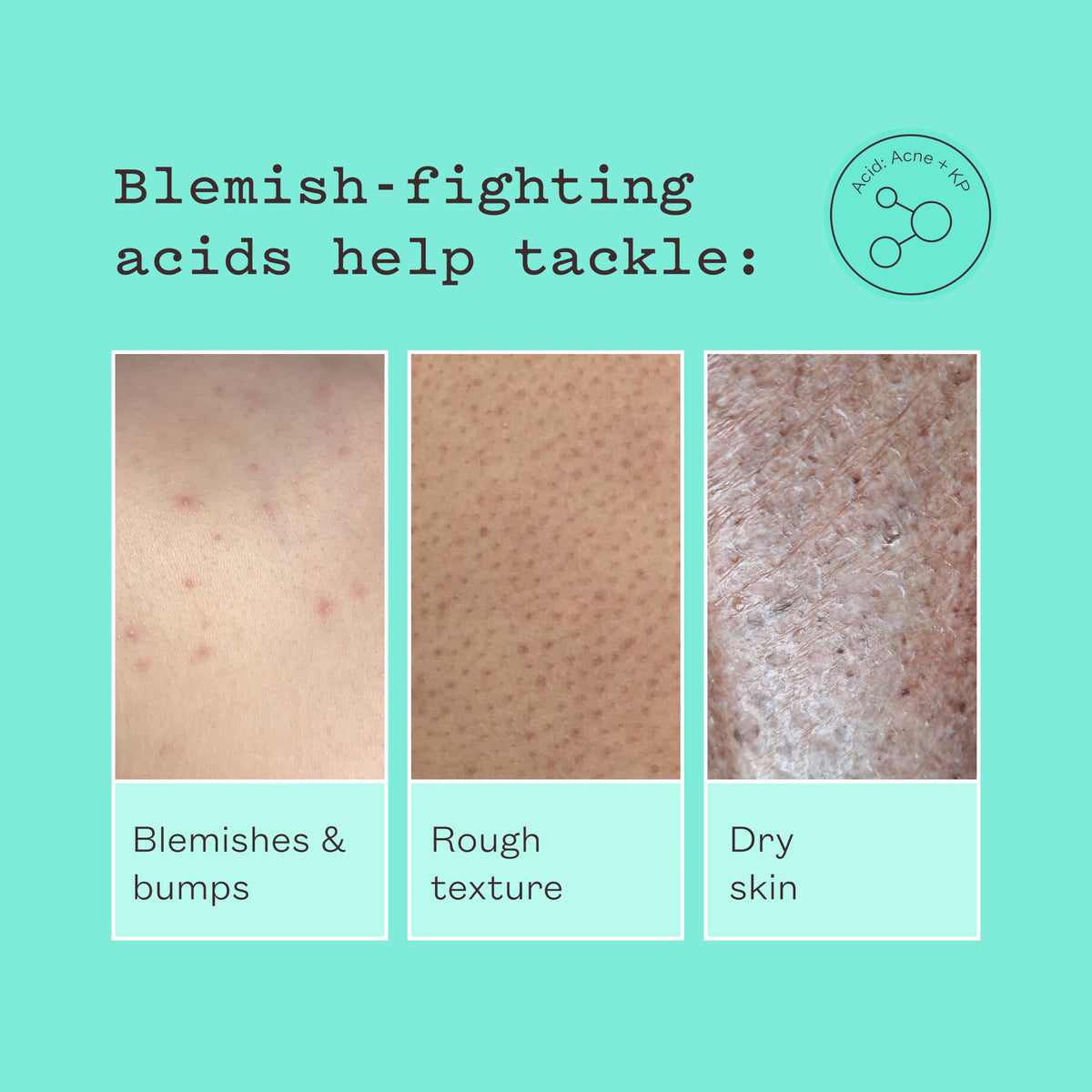 frank body Glycolic Acid Body Scrub | Exfoliating Body Scrub for Strawberry Skin, KP, Bumps & Ingrowns | Smooths Rough Skin on Legs, Arms, Back & Bum | Niacinamide, Witch Hazel & Pumice | 8.82 oz
