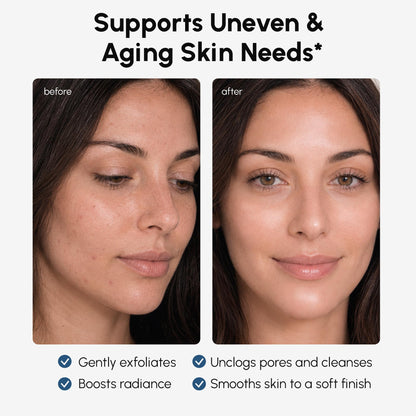 MAREE Toner Glycolic Acid Exfoliating Toner for Face Acido Glicolico para Manchas
