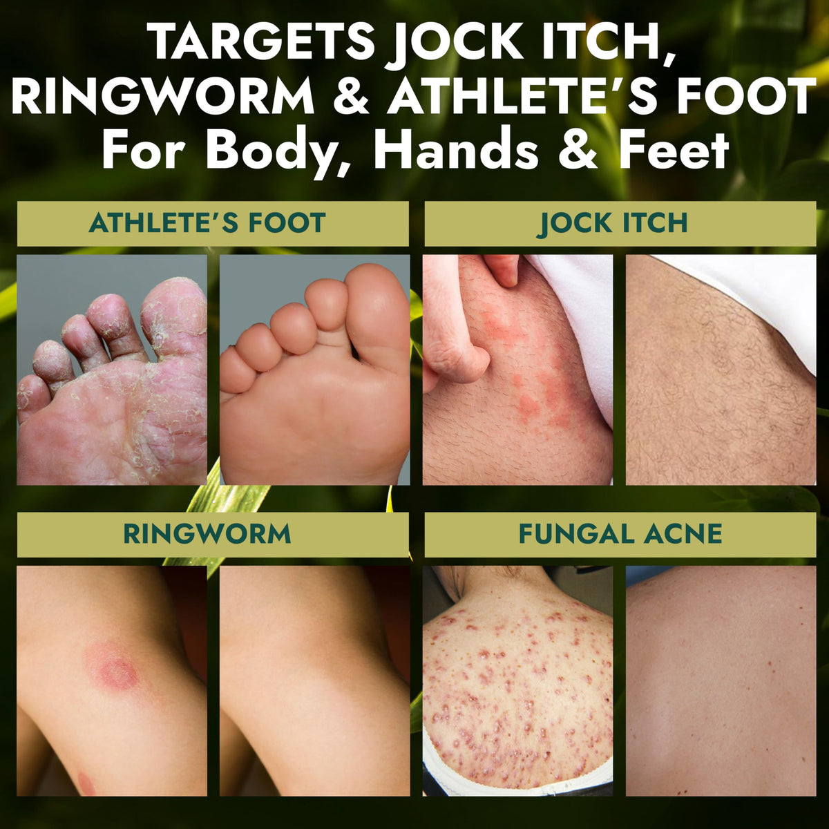 Antifungal Soap Medicated Jock Itch Treatment with Tea Tree Oil 2 Pack