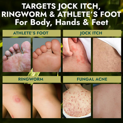 Antifungal Soap Medicated Jock Itch Treatment with Tea Tree Oil 2 Pack