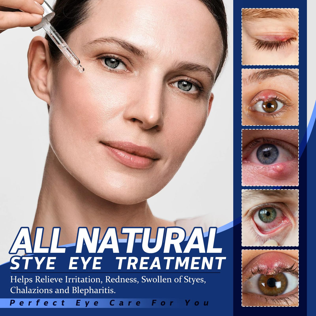 Stye Eye Treatment, Natural Non-Irritating Formula Eyelid Relief 30ml(1PCS)