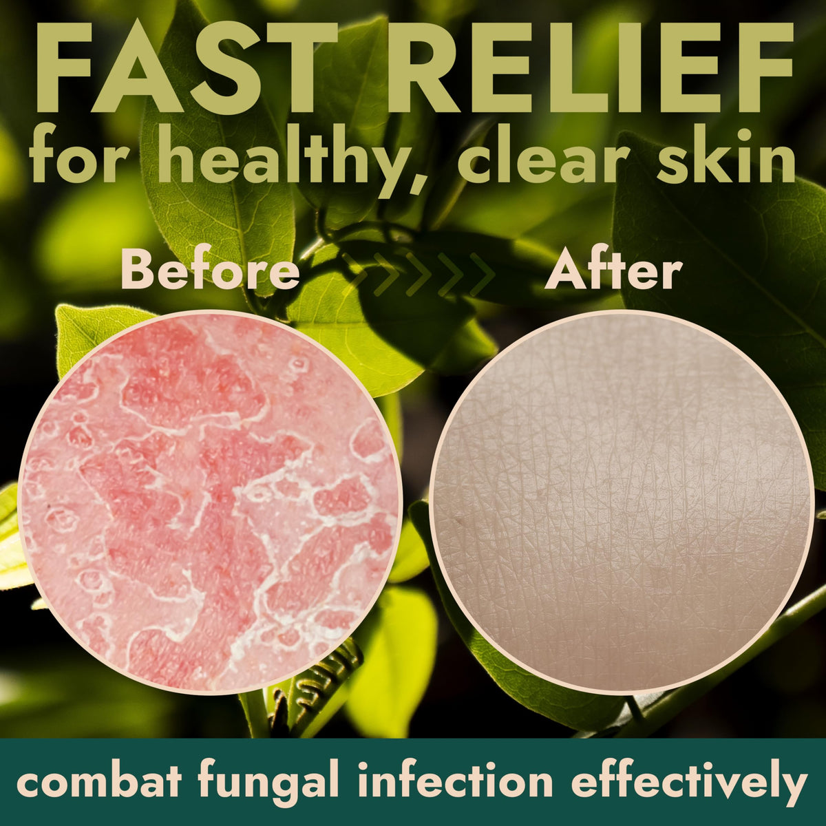 Antifungal Soap Medicated Jock Itch Treatment with Tea Tree Oil 2 Pack