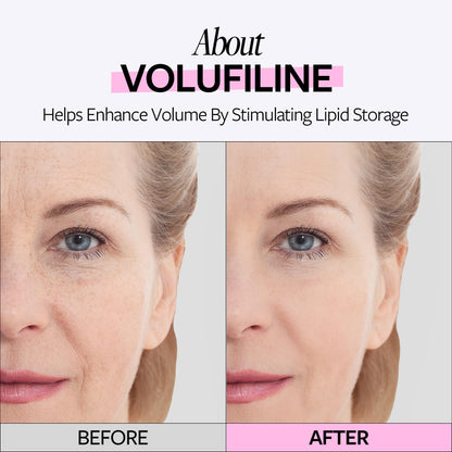 RECIPE Volufiline 100% Ampoule - From France, Sederma - Pure Volufiline Serum - DIY Skin Care Booster for Face & Body – Hydrating & Age-Defying Formula for Elevated Resilience (0.33 fl oz)