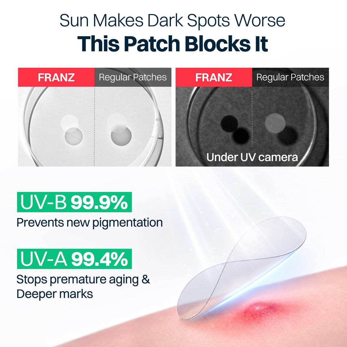 FRANZ Invisible Post-Acne Mark Patches for Dark Spots, 72 Count