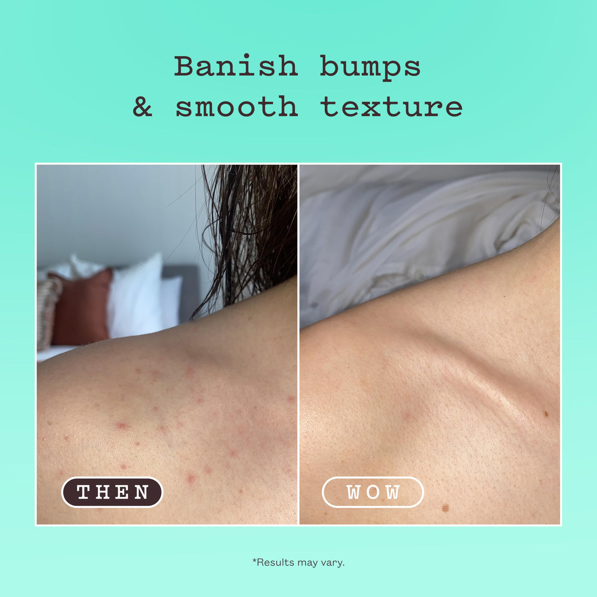 frank body Glycolic Acid Body Scrub | Exfoliating Body Scrub for Strawberry Skin, KP, Bumps & Ingrowns | Smooths Rough Skin on Legs, Arms, Back & Bum | Niacinamide, Witch Hazel & Pumice | 8.82 oz