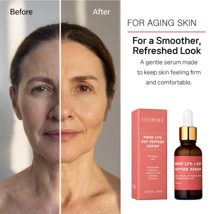 Salmon DNA PDRN 120,000 ppm EGF Peptide Microneedling Serum w/Volufiline, Phyto PDRN 12%, Growth Factor - Anti-Aging Face Serum with Niacinamide, Hyaluronic Acid 1 Fl Oz Korean Skincare