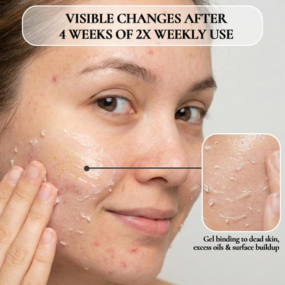 Vivo Per Lei Facial Peeling Gel - Exfoliates Dead Skin - Gentle - 4.05 Oz