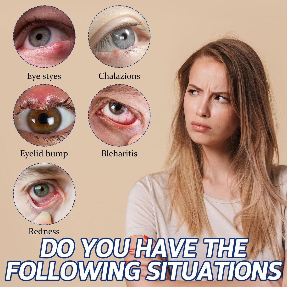 Stye Eye Treatment, Natural Non-Irritating Formula Eyelid Relief 30ml(1PCS)