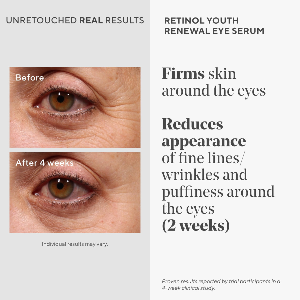Murad Retinol Youth Renewal Eye Serum - Retinol for Firming - 0.5 Fl Oz