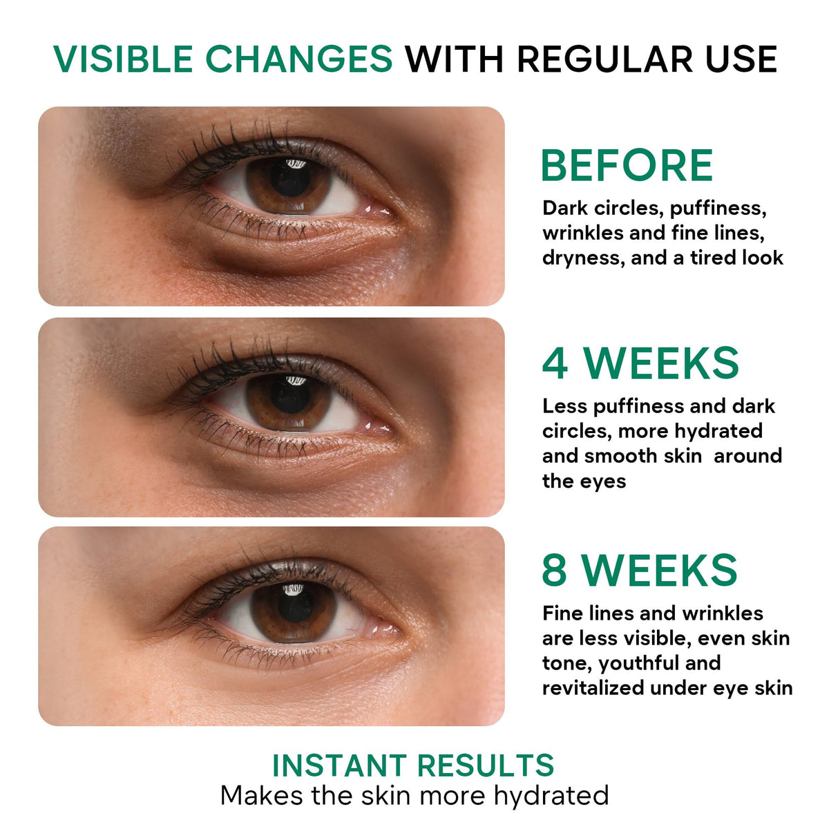 Under Eye Cream - Retinol, Caffeine & Niacinamide Care for Dark Circles