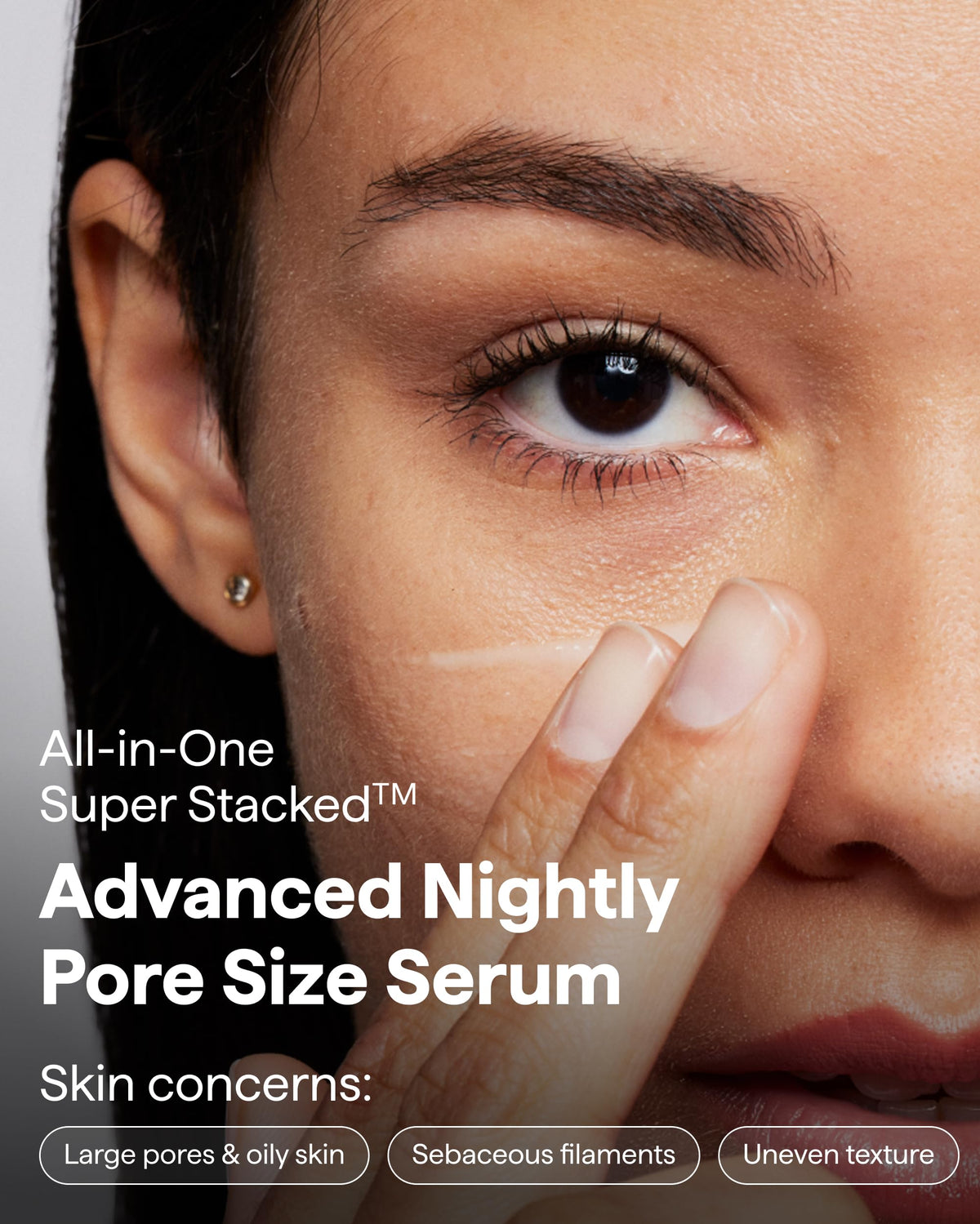 REMEDY for Pore Size, Pore Refining Advanced Serum for Blackheads & Pimple