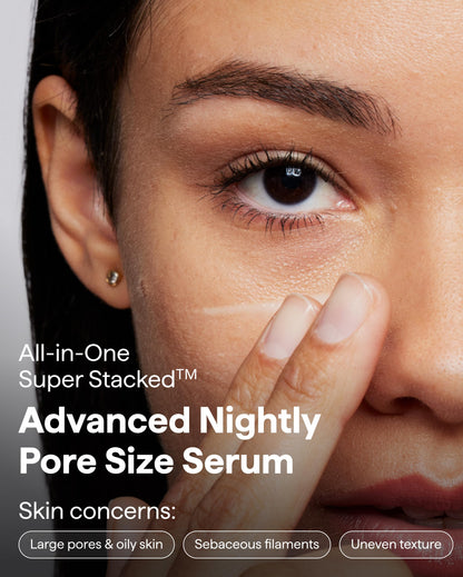 REMEDY for Pore Size, Pore Refining Advanced Serum for Blackheads & Pimple