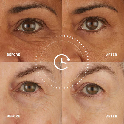 Skyn ICELAND Hydro Cool Firming Eye Patches with Peptides and Coenzyme Q10