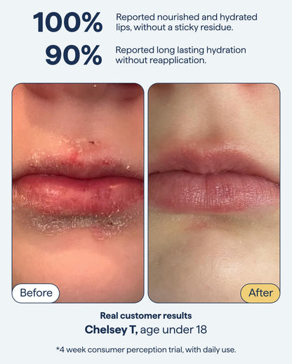 REMEDY for Dry Lips, All-In-One Hydrating Lip Treatment with Ceramides