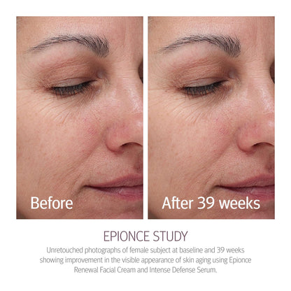 Epionce Renewal Facial Cream Hydrating Anti-Aging Skin Barrier Moisturizer