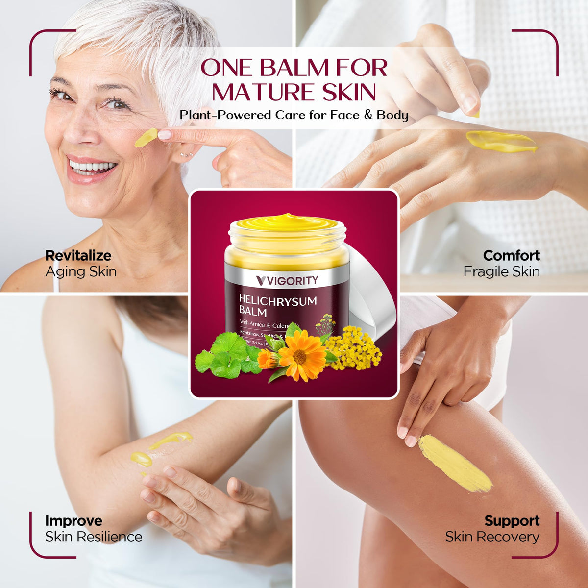 Vigority Helichrysum Balm Soothes & Repairs: Restorative Arnica Cream with Calendula for Fragile, Thin Skin & Bruise-Prone – Moisturizes, Revitalizes & Strengthens Skin Barrier for Adult Seniors 3.4oz