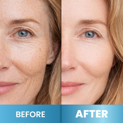 Retinol Cream for Face - Anti-Aging Moisturizer Wrinkle Cream with Collagen
