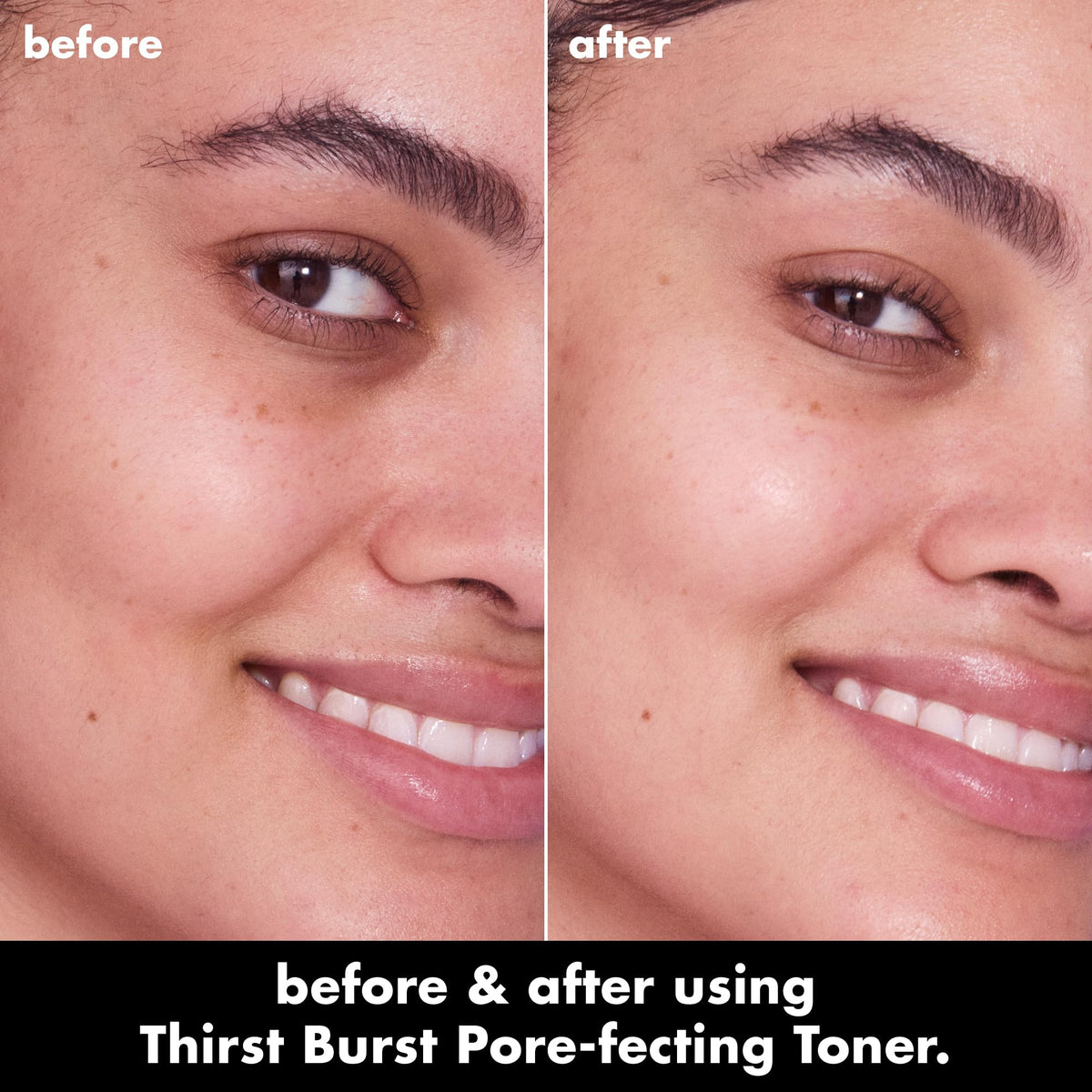 e.l.f. SKIN Thirst Burst Pore-fecting Toner, Hydrating for Face, Smooths, Plumps & Minimizes Pores, Infused with Salicylic Acid, Vegan & Cruelty-Free