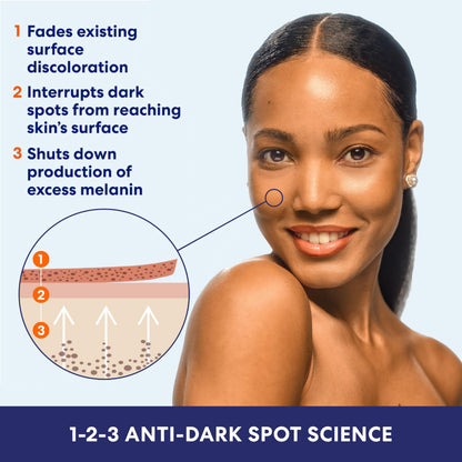 Palmer's Skin Success Anti-Dark Spot Fade Cream with Vitamin E (4.4 Oz)
