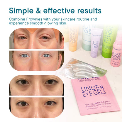 Frownies Cactus Collagen Under Eye Gels, 3 Sets
