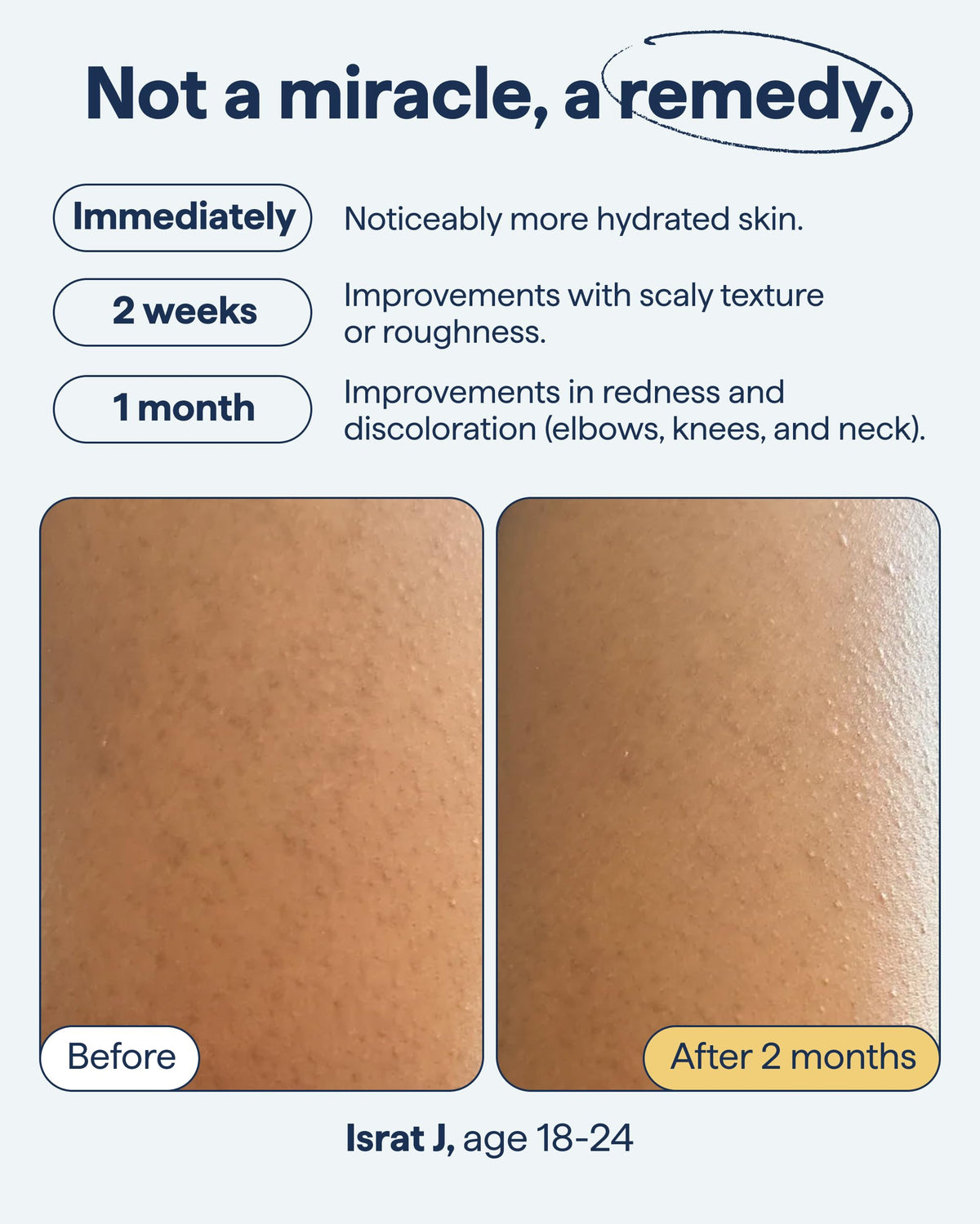 REMEDY KP Body Moisturizer, Exfoliating and Moisturizing Lotion