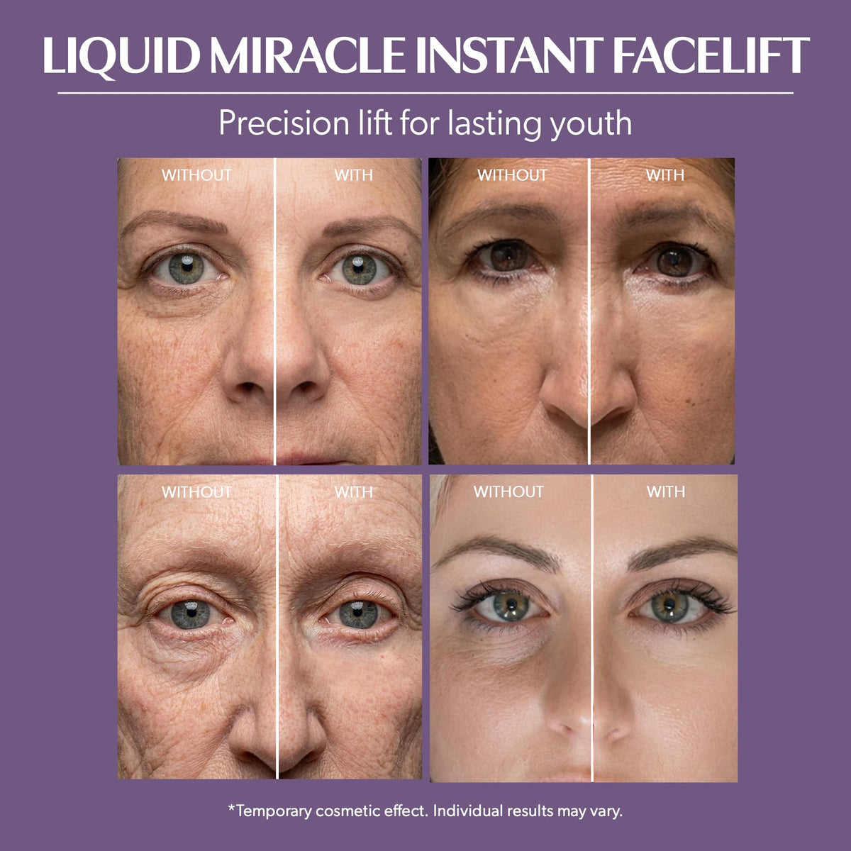 Beverly Hills Instant Facelift Anti Aging Eye Serum Treatment for Dark Circles, Puffy Eyes, Wrinkles, Under Eye Bags, Fine Lines, and Crows Feet | 30mL (120 Days Supply)